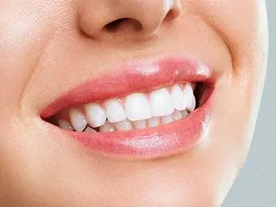 بهترین نوع روکش