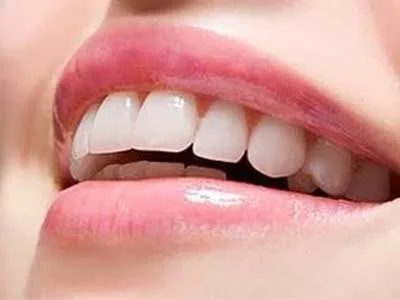 مراحل روکش