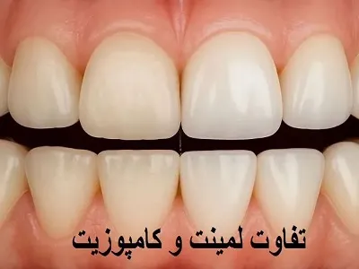تفاوت لمینیت و کامپوزیت 