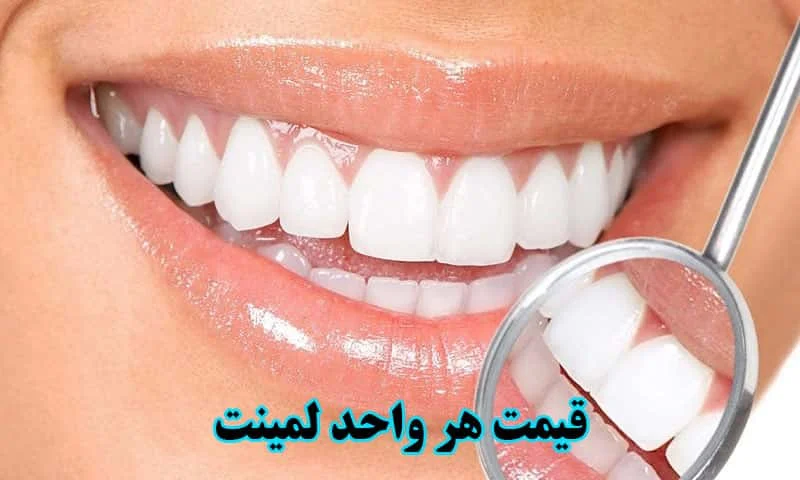 قیمت هر واحد لمینت - سرامیک، زیرکونیا، رزین و پرسلن