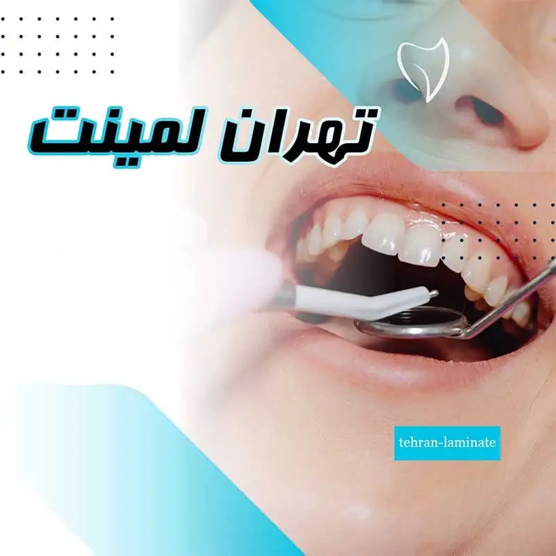 لمینت دندان لمینت دندان