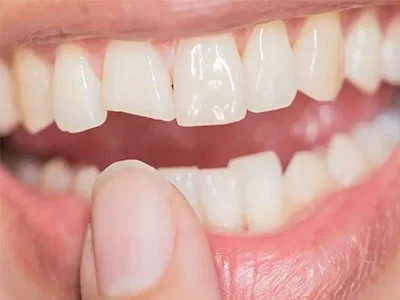 معایب لمینیت